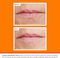 113556 - SPF 15 Lip Repair & Protect Balm, 4.2g
